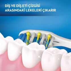 Oral-B Titreşimli Diş Fırçası Pro-Expert Pulsar 35 Orta - 4